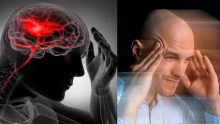 इन चार कारणों से होता है ब्रेन स्ट्रोक, इसे नजरअंदाज करना हो सकता है जानलेवा